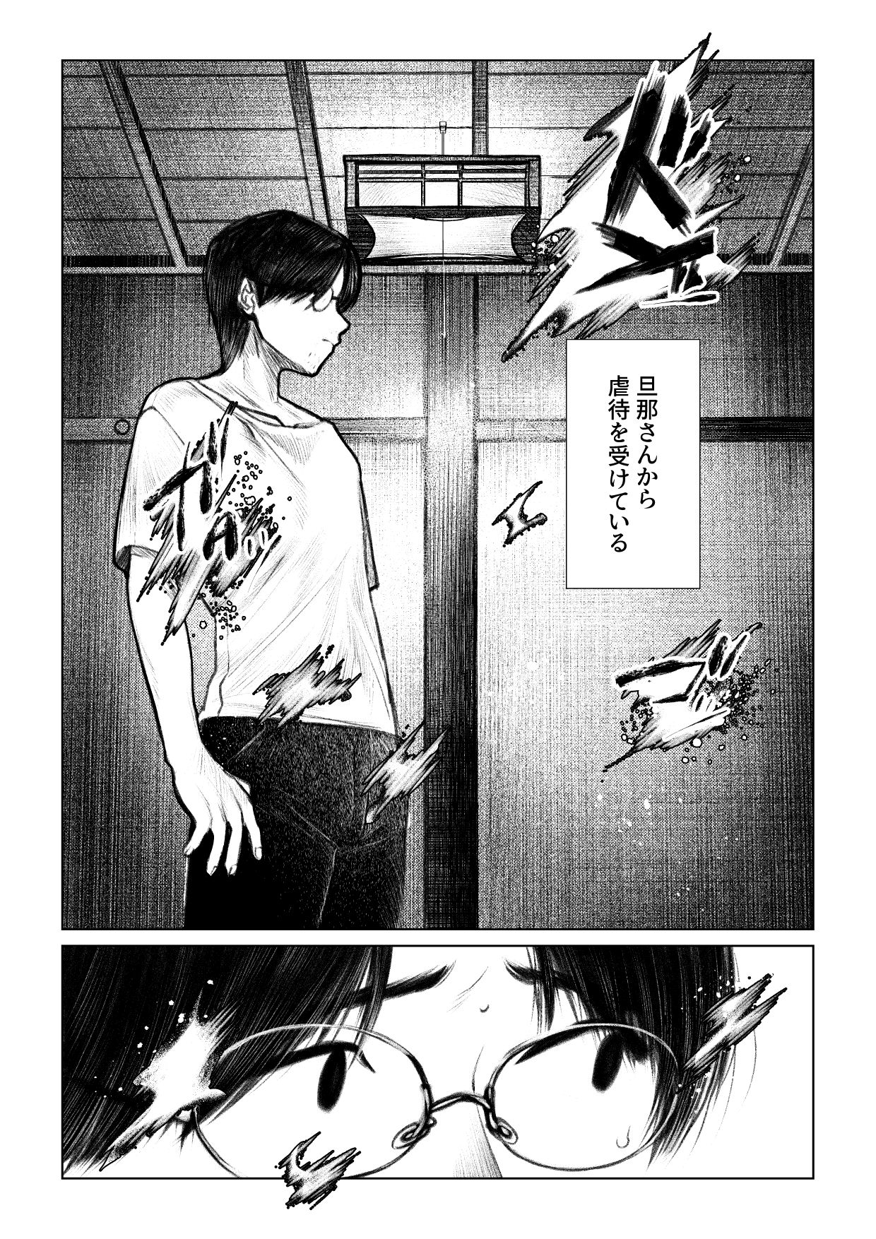 痣と痕_2