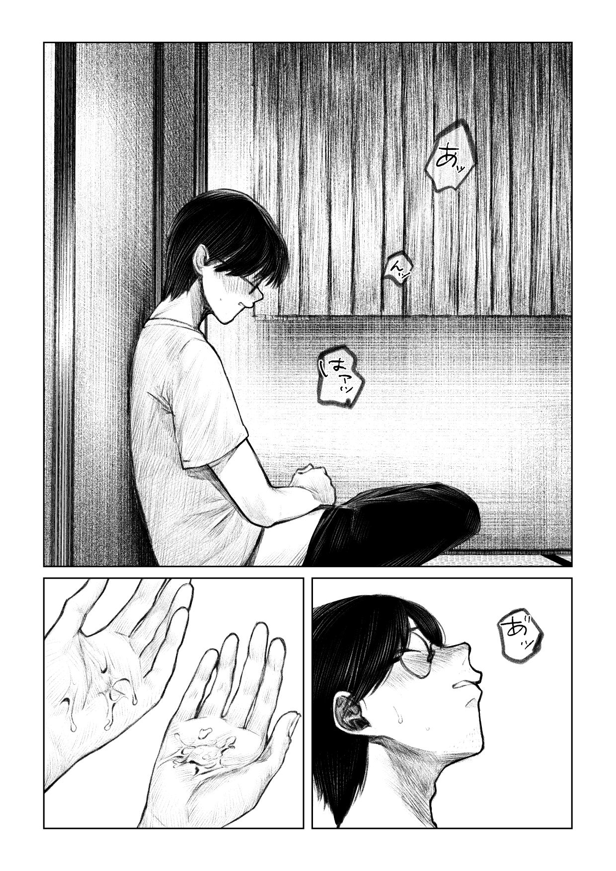 痣と痕_6