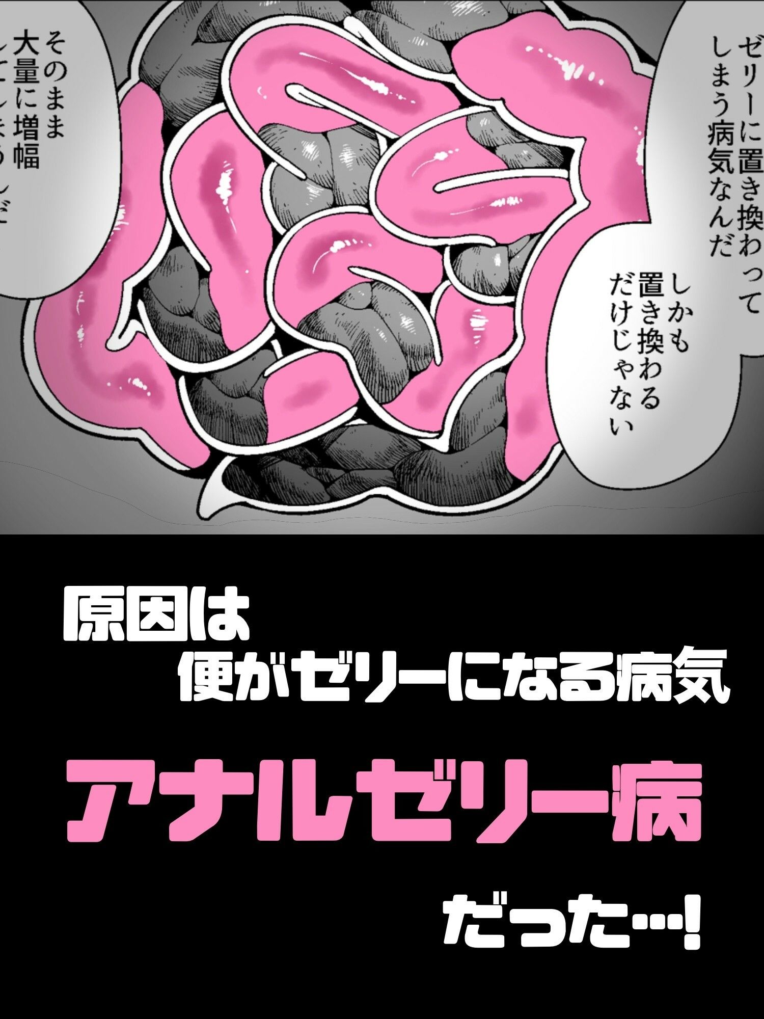アナルゼリーという病〜人妻OLは我慢も虚しく巨尻からゼリーを吹き出す〜_3